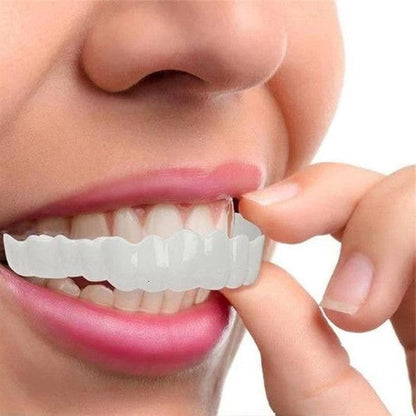 Snap-On Smile Veneers – Upper & Lower Teeth Covers for a Perfect Smile