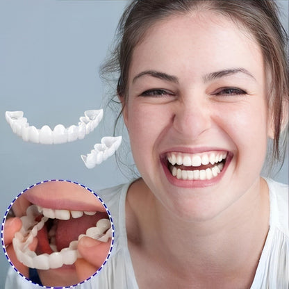 Snap-On Smile Veneers – Upper & Lower Teeth Covers for a Perfect Smile