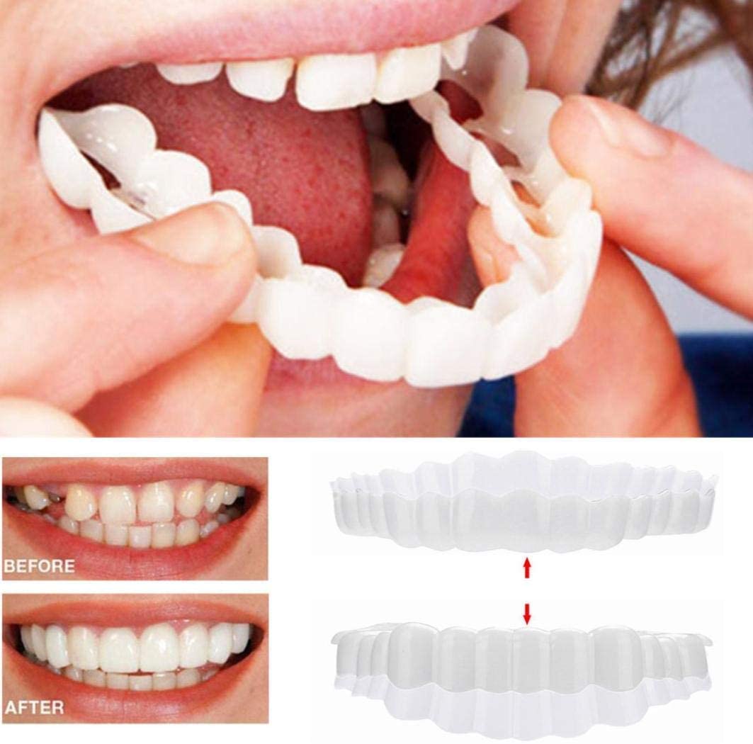 Snap-On Smile Veneers – Upper & Lower Teeth Covers for a Perfect Smile