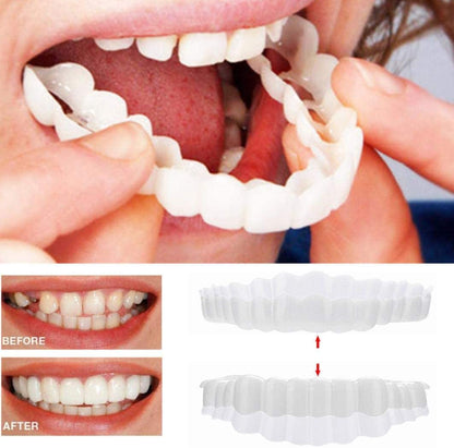 Snap-On Smile Veneers – Upper & Lower Teeth Covers for a Perfect Smile