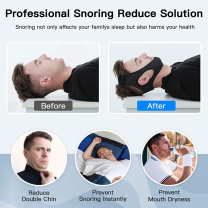 Anti-Snoring Chin Strap for Sleep Apnea – Adjustable Jaw Support Band