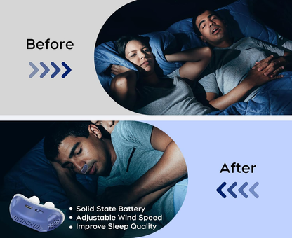 Micro CPAP Sleep Apnea Machine – Hoseless Travel CPAP Anti-Snoring Device