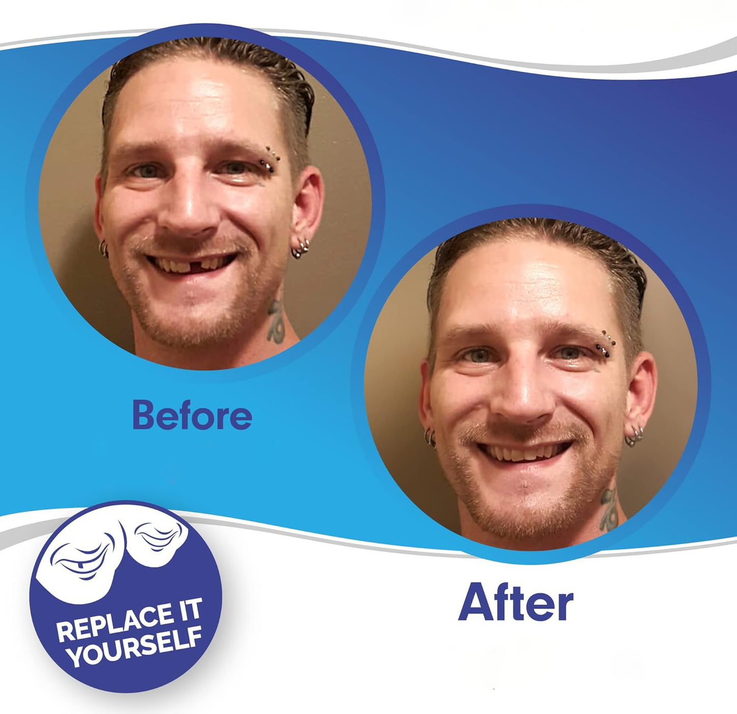 Snap-On Smile Veneers – Upper & Lower Teeth Covers for a Perfect Smile