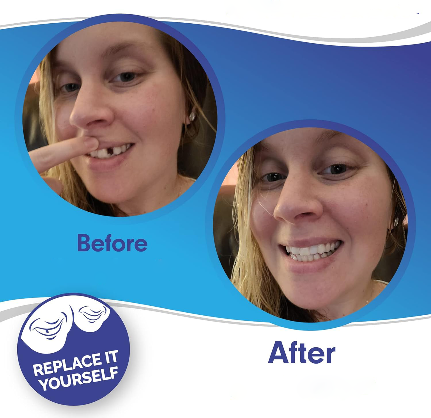 Snap-On Smile Veneers – Upper & Lower Teeth Covers for a Perfect Smile