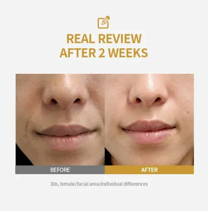 Kojic Acid & Niacinamide Dark Spot Serum – Brightening Whitening Cream for Face