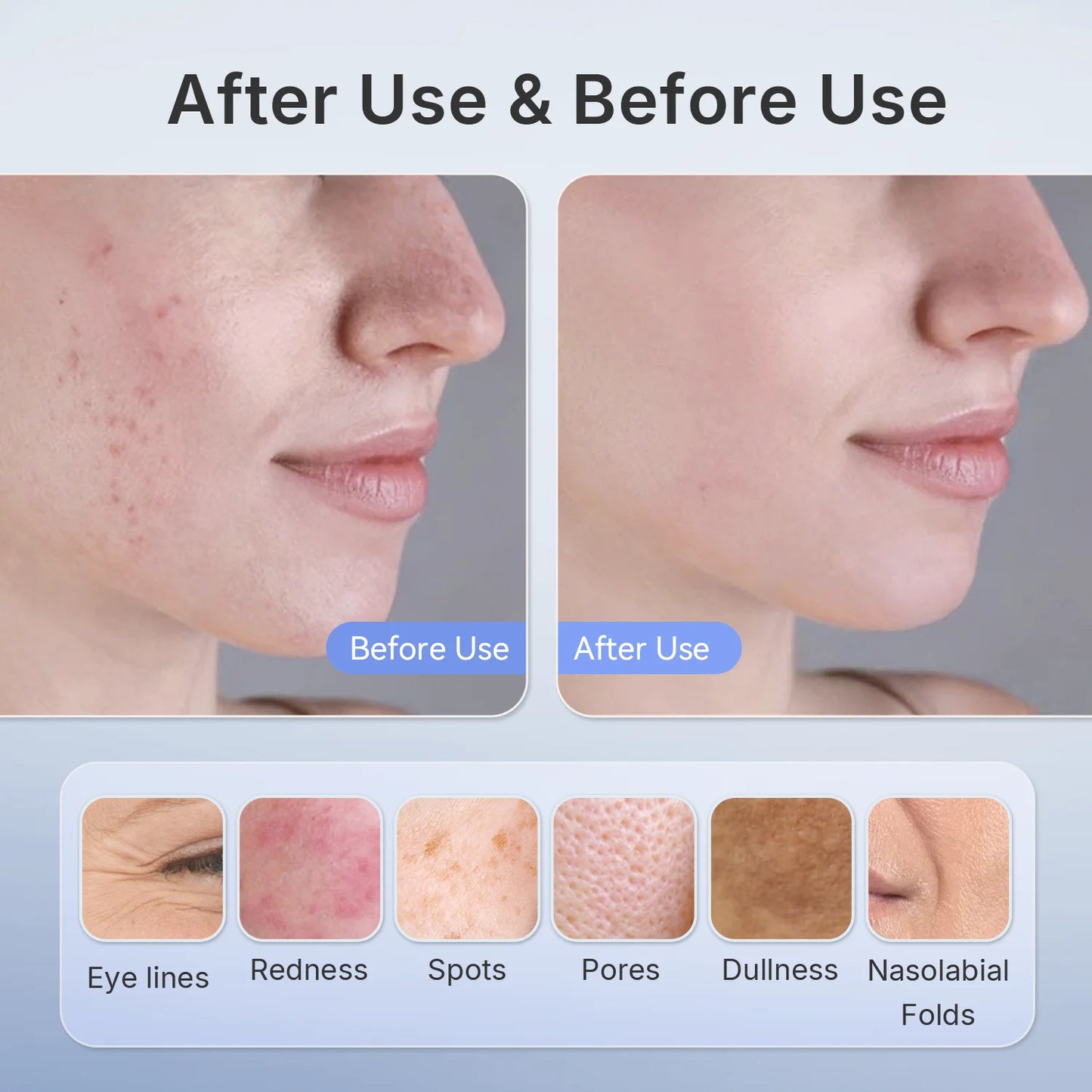 510K LED Red & Near-Infrared Light Therapy Face Mask – Professional Anti-Aging Mask
