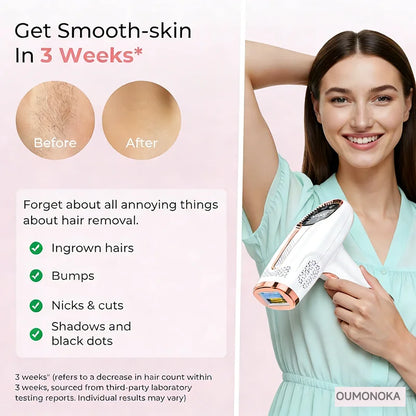 IPL Permanent Laser Hair Removal Device – At-Home Epilator for Women & Men