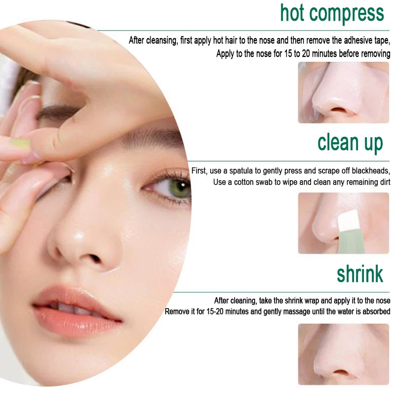 Blackhead & Whitehead Removal Tool – Deep Pore Cleansing Beauty Tool