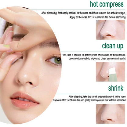 Blackhead & Whitehead Removal Tool – Deep Pore Cleansing Beauty Tool