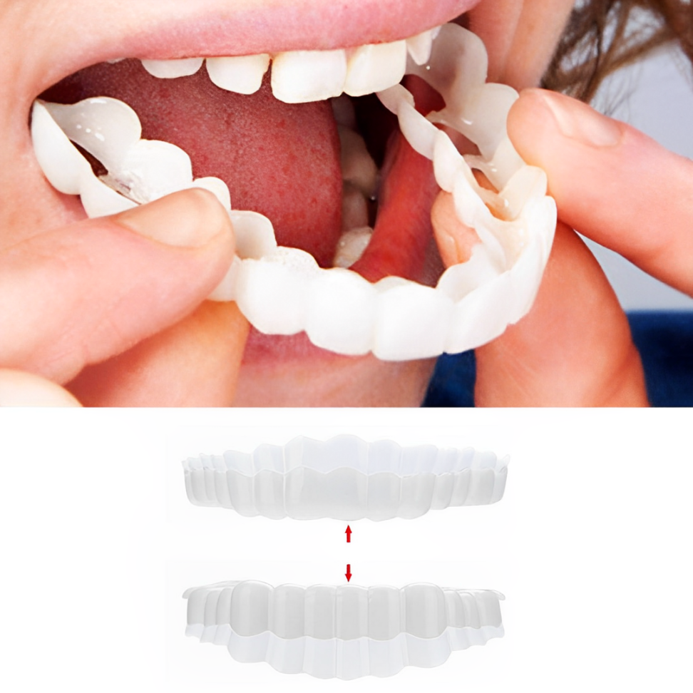 Snap-On Smile Veneers – Upper & Lower Teeth Covers for a Perfect Smile