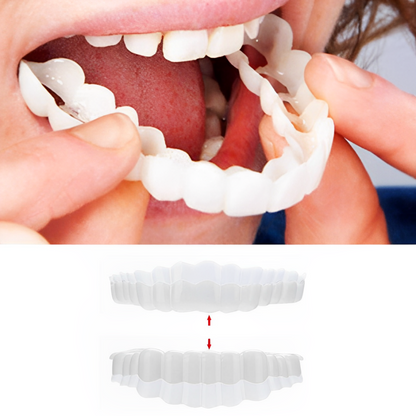 Snap-On Smile Veneers – Upper & Lower Teeth Covers for a Perfect Smile