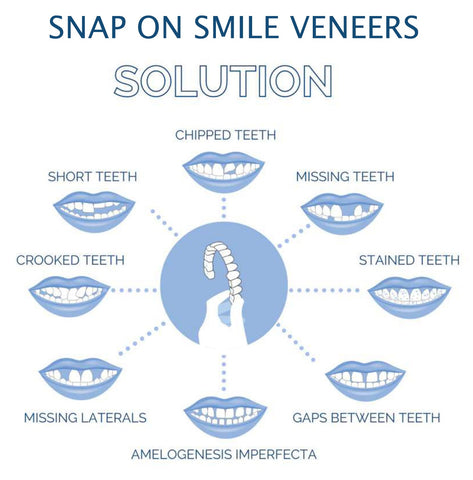 Snap-On Smile Veneers – Upper & Lower Teeth Covers for a Perfect Smile