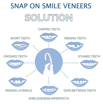 Snap-On Smile Veneers – Upper & Lower Teeth Covers for a Perfect Smile